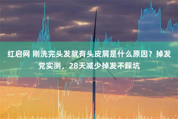 红启网 刚洗完头发就有头皮屑是什么原因?掉发党实测,28天减少掉发不踩坑